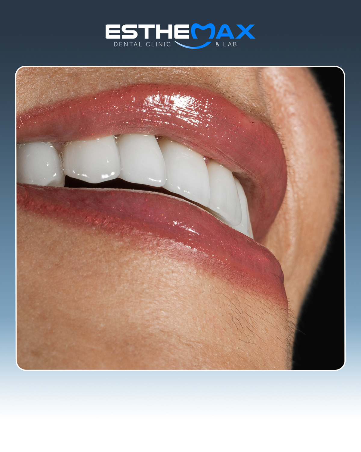 Dental work - smile makeover