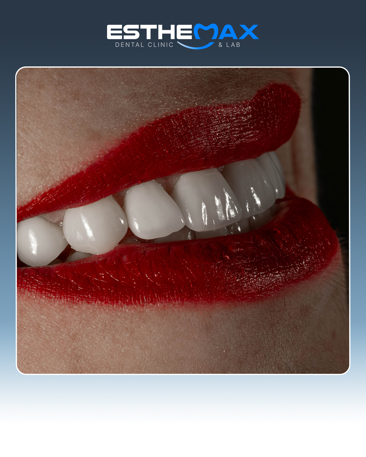 Smile detail by ESTHEMAX