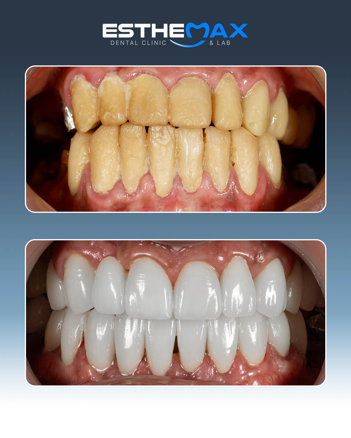 Dental work - enhancement